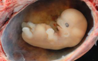 На какой неделе беременности обычно начинается токсикоз и как с ним бороться на ранних сроках?